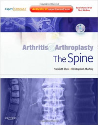 Image of Arthritis dan Arthroplasty: The Spine