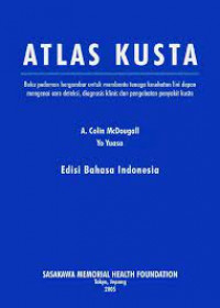 Image of Atlas Kusta