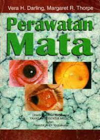 Image of Perawatan Mata