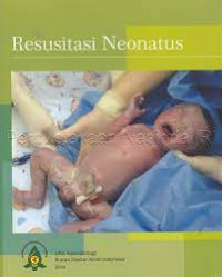 Image of Resusitasi Neonatus