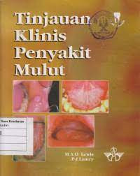 Image of Tinjauan Klinis Penyakit Mulut