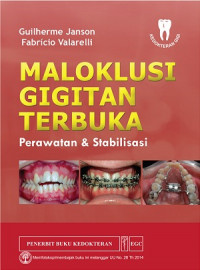 Image of Molaklusi Gigitan Terbuka: Perawatan dan Stabilisasi